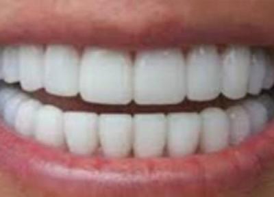 بخش های مختلف دندان انسان